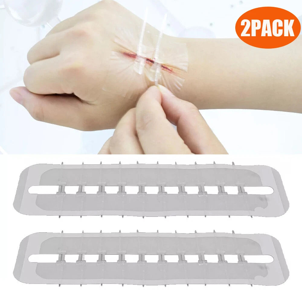 2Pcs Wound Closure Strips for Emergency Protection Zip Stitch Sutures